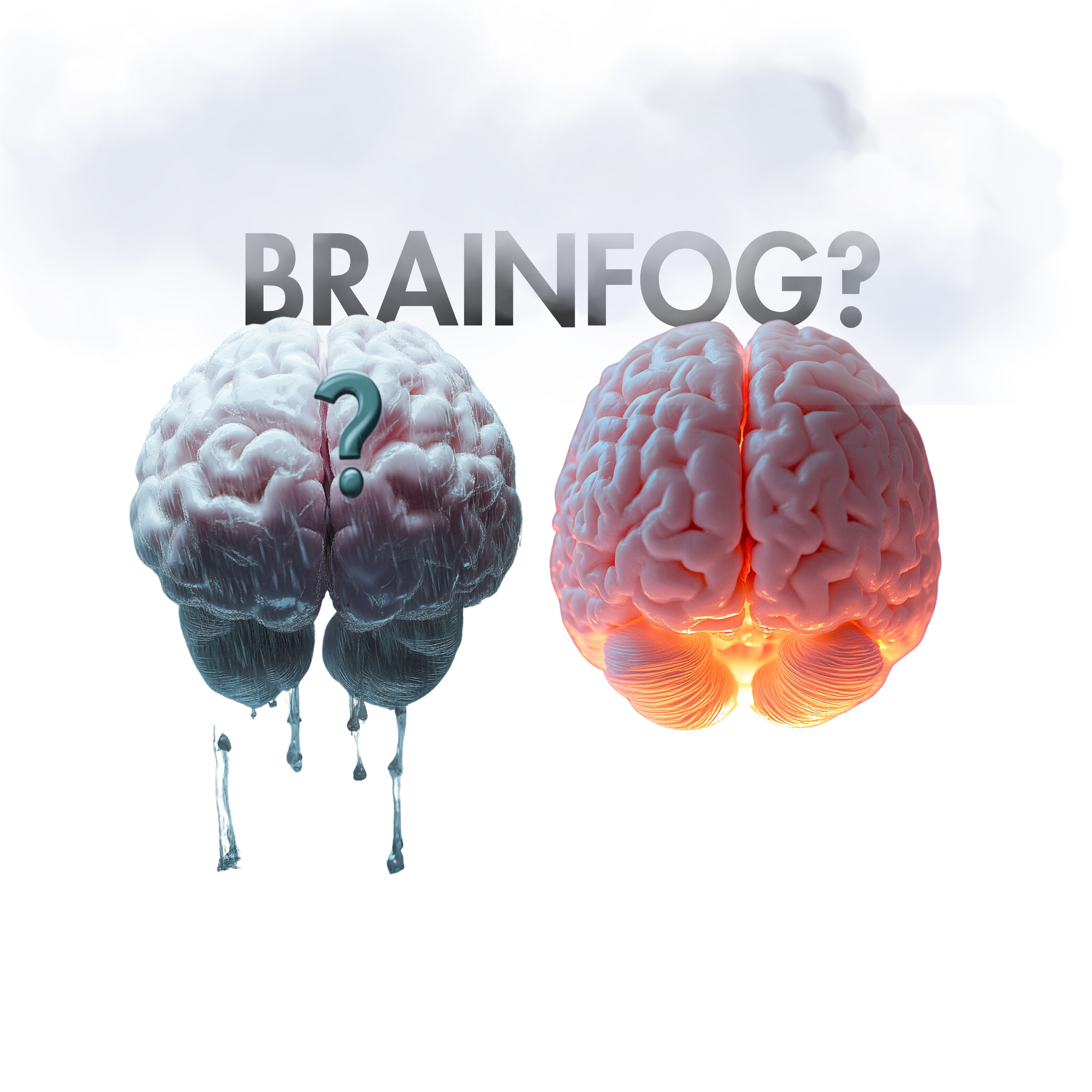 Brainfog?